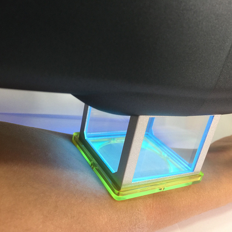 308nm Ultraviolet Light Therapy Device